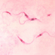 Illustration for article titled Can the United States Cope With a Resurgence of Tropical Disease?